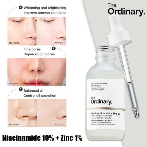 Face Serum : Niacinamide 20% + Zinc 1% - 30ml